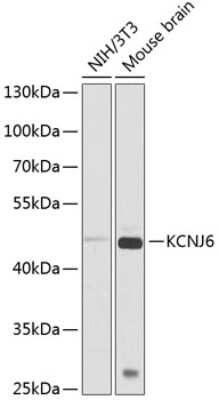 Western Blot: GIRK2 AntibodyBSA Free [NBP3-03526]